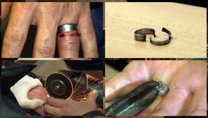 Mužovi sa na prste zasekol prsteň. Pomáhali aj hasiči