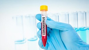 Prišiel vám cez SMS výsledok testu, no žiaden ste neabsolvovali? Toto je odôvodnenie ministerstva