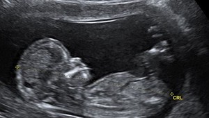 Bieber bude OTCOM! Ale má to jeden háčik...