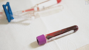 Dôvera v tradičnú medicínu: Kde sa v prieskume umiestnili Slováci?