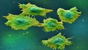 Nový vedecký objav je nádejou v liečbe rakoviny!