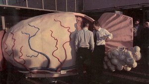 To ste ešte nevideli! Takto vyzerá prostata zvnútra