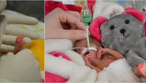 Neuveriteľné! V českej nemocnici zachránili iba 322-gramové predčasniatko!