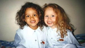 Ich narodenie bolo pred rokmi svetovou senzáciou: Keď ich uvidíte dnes, pochopíte prečo