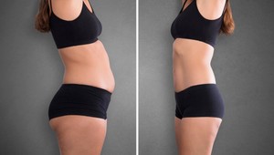 6 nenáročných trikov pred spaním, s ktorými schudnete rýchlejšie: Funguje to!