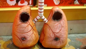 Rakovina pľúc zabíja Slovákov. Vláda chce preto spustiť národný skríningový program.