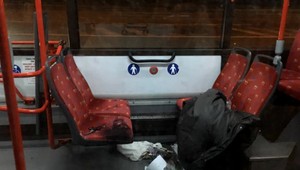 Poleptaná žena v bratislavskej MHD. Bola to vysoko koncentrovaná kyselina