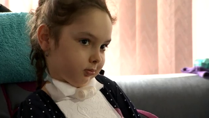 Krásna Nikolka sa narodila úplne zdravá: V 3. rokoch prišla krutá rana - zákerná choroba!