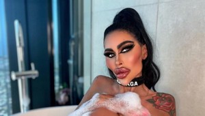 Zbláznená do plastík. Z niekdajšej krásnej zdravotnej sestry sa stala KRÁĽOVNÁ kreatúr