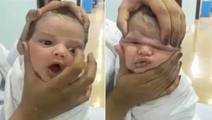 VIDEO: Svet je zdesený z toho, čo zdravotné sestry spravili novorodencovi