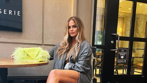 Krásna Chrissy Teigen šokuje! Nechala si odsať tuk z tváre a sekla s TÝMTO neduhom!