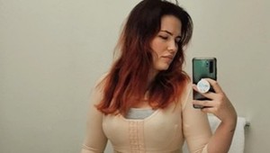 Chcela si vylepšiť postavu po pôrodoch, teraz TO ľutuje: Takto jej plastika zničila telo