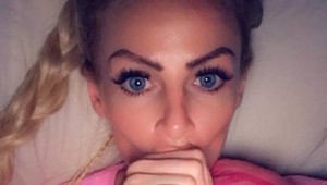 Nechala si zväčšiť pery, teraz to ľutuje: Takú hrôzu nečakala ani v najhoršom sne!