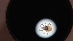 Máte čudné príznaky? Možno máte lymskú boreliózu