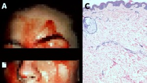 Žena potí krv. Lekári jej pomôcť nevedia