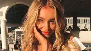 Po dlhých rokoch sa zbavila ťažkého akné: TOTO modelke vyliečilo pleť