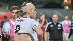 Pozor letí kameň! Dudu trafil v Tirane ostrý predmet do hlavy