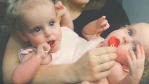 Dávali im minimálnu šancu na život: Oddelené siamské dvojičky majú 17 rokov