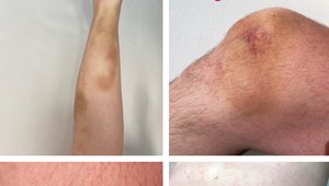 Homofóbny útok v centre Bratislavy: Môže za vzrastajúcu nenávisť rétorika politikov? Expert reaguje