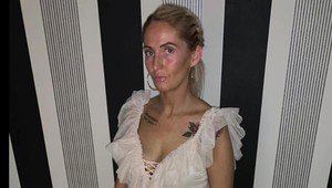 Naniesla si samoopaľovací krém a išla spať: Keď sa ráno uvidela, rozplakala sa