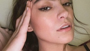 Je prirodzene krásna, no každý deň čelí kritike: Pozrite sa na jej tvár a pochopíte dôvod