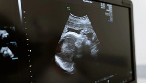 Náboženská mimovládka bránila dievčaťu (12) ísť na potrat. Dieťa čaká so svojím otcom