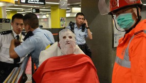 Muž sa zapálil v metre plnom ľudí