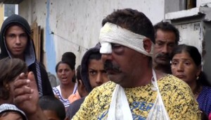 V osade v Nálepkove vypukla hromadná bitka. Podľa zbitých bezdôvodne