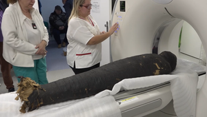 Netradičný pacient: CT vyšetrenie podstúpila múmia stará 5-tisíc rokov