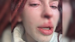 Prípad dobitej influencerky Ráchel: Čo radí psychologička týraným ženám?