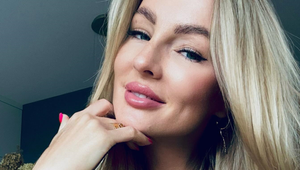 Iba za 3 týždne jej zmizli póry: Kristína prezradila svoj tip a krém to nie je!