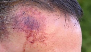 Tomáš sa s rodinou vybral vinšovať zdravie svojim rodičom. Cestou k nim ho zbili