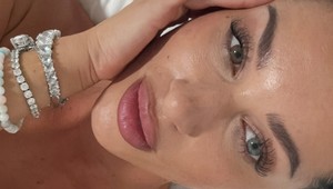 Bianka Rumanová kvôli reality šou radikálne zmenila vzhľad: ČO sa jej to stalo s tvárou?