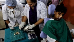 Lekári odstránili chlapcovi 232 zubov