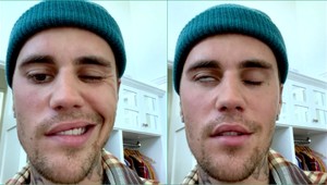 Kanadskej hviezde OCHRNULA polovica tváre!