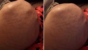 Zázračné video: Podarilo sa zachytiť pohyby bábätka tesne pred pôrodom!