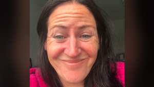 Nataša neverila vlastným očiam: TOTO dokáže s vašou tvárou urobiť len botox!