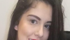 Pre jej zuby ju neprijali do práce: Mala ich naozaj také zlé?