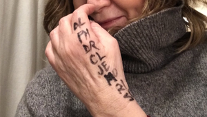 Česká speváčka po mesiacoch zhodila parochňu a ukázala, čo pod ňou skrýva: Toto s ňou urobila vážna choroba!