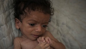 Nemecké mestá a aj Viedeň chcú prijať deti z Gazy