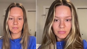 Žena na vlastnej tvári ukázala, ako za pár sekúnd omladla: Je toto naozaj možné?