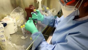 List chirurga z Bergama: Pracovná doba už neexistuje. Pre nás je osobný život pozastavený