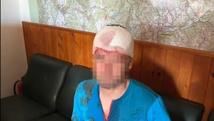 Ďalší útok medveďa: Horský záchranár skončil s ranou na hlave v nemocnici