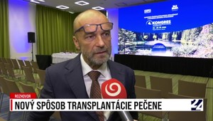 Rozhovory 24: Nový spôsob transplantácie pečene