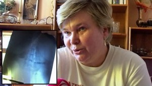 Zabudli jej rúško v bruchu. Vyšetrovanie však trvalo príliš dlho...