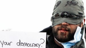 Migranti v Calais si zašili ústa, protestujú tak proti rušeniu tábora