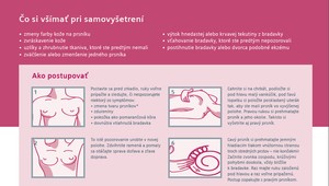 Takto nájdete každú podozrivú zmenu: Ako si samovyšetrovať prsia?
