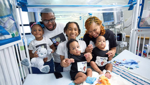 Lekári rozdelili siamské dvojčatá. Na operáciu sa pripravovali takmer rok