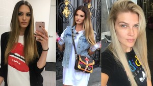 Veľká zmena v životoch známych Sloveniek: Tak TOTO chcelo poriadnu odvahu