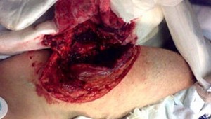 Žraloci zaútočili na surferov a plavkyňu